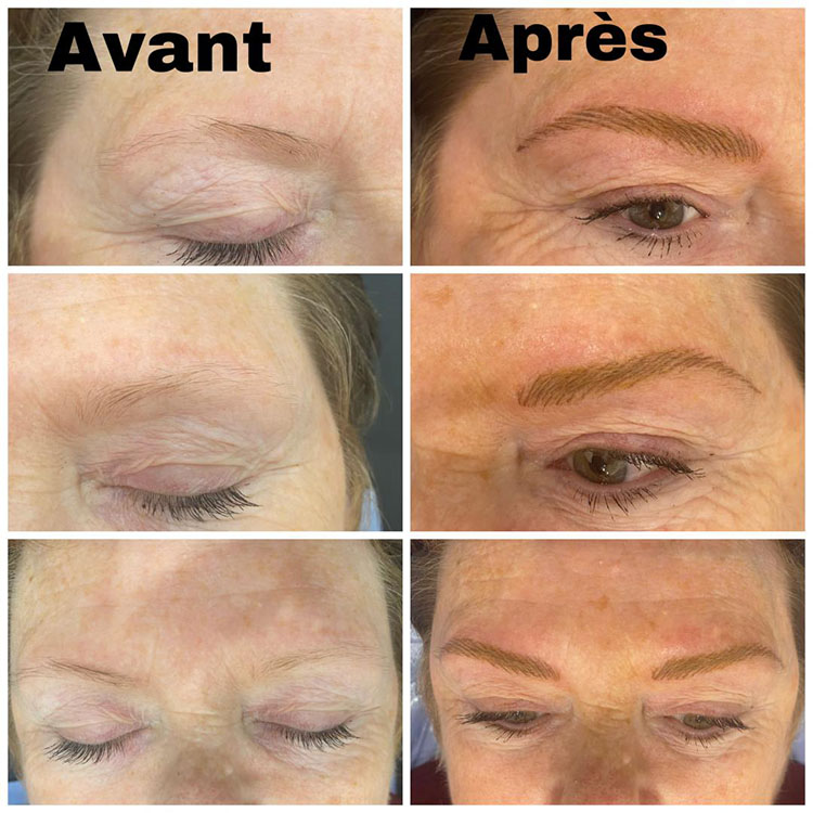 Épilation Perpignan
